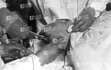 Schönheitsoperation