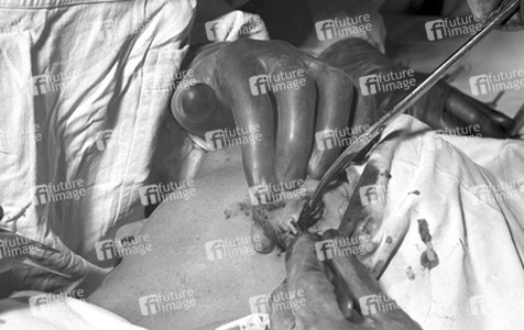 Schönheitsoperation