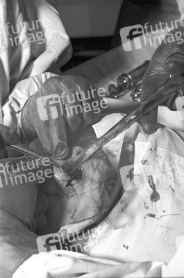 Schönheitsoperation