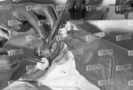 Schönheitsoperation