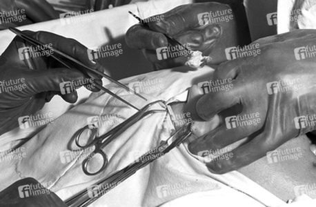 Schönheitsoperation