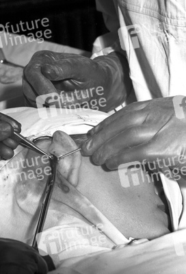 Schönheitsoperation