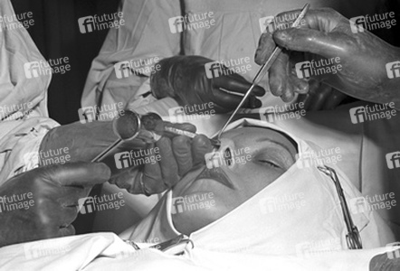 Schönheitsoperation