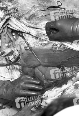 Operation 'Blaues-Baby-Krankheit'