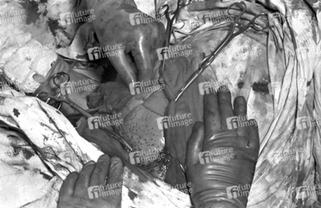 Operation 'Blaues-Baby-Krankheit'