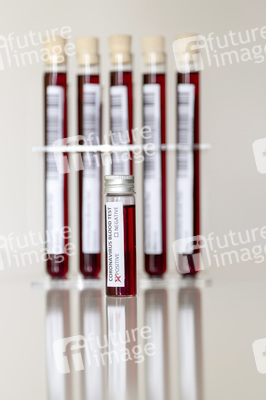 Symbolfoto Coronavirus