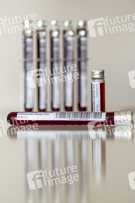 Symbolfoto Coronavirus