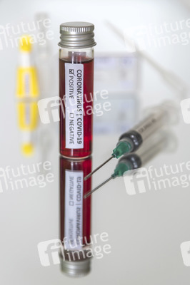 Symbolbild Antikörper-Test für Coronavirus