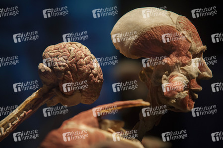 Ausstellung 'Body Worlds - The Rhythm of Life' in Madrid