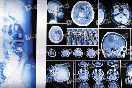 Symbolfoto Kriminaltechnisches Labor