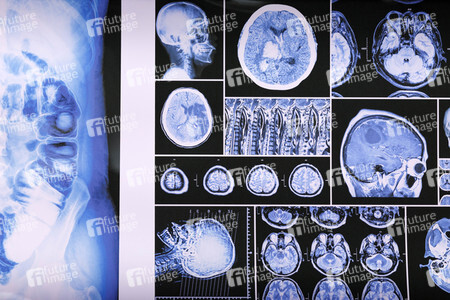 Symbolfoto Kriminaltechnisches Labor