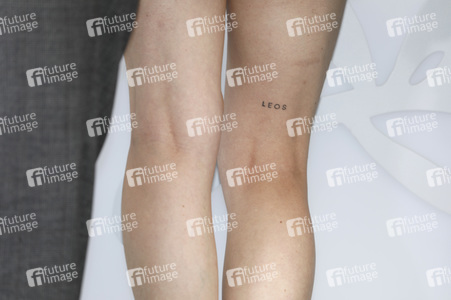 Photocall mit Alice und Alba Rohrwacher, Cannes Film Festival 2022