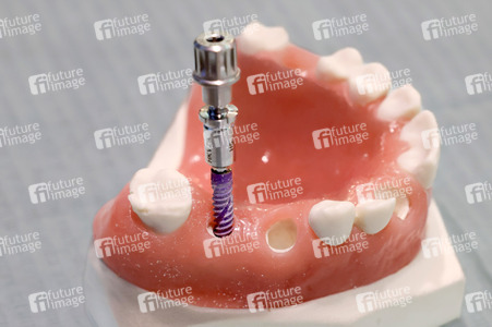 Internationale Dental-Schau - ITS 2025 in Köln