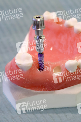 Internationale Dental-Schau - ITS 2025 in Köln