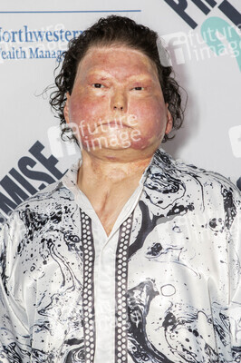 Promise2Live Global Livestream Event in Los Angeles