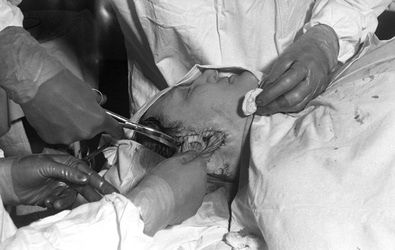 Schönheitsoperation