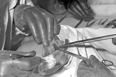 Schönheitsoperation