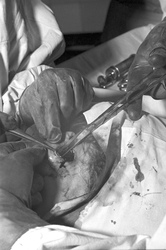 Schönheitsoperation