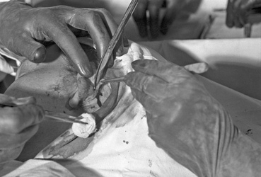 Schönheitsoperation