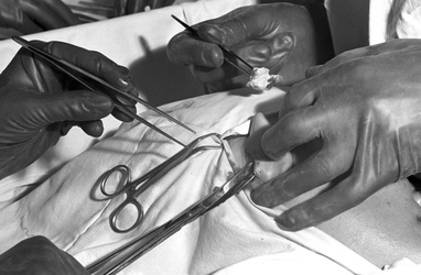 Schönheitsoperation