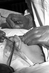 Schönheitsoperation