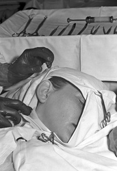 Schönheitsoperation