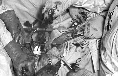 Operation 'Blaues-Baby-Krankheit'