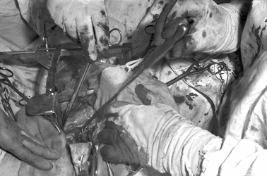 Operation 'Blaues-Baby-Krankheit'