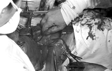 Operation 'Blaues-Baby-Krankheit'