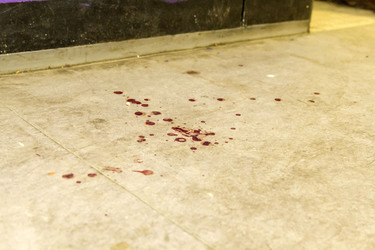 Polizeieinsatz nach Messerattacke, Berlin