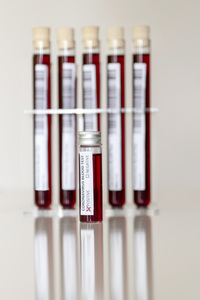 Symbolfoto Coronavirus