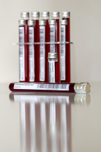 Symbolfoto Coronavirus