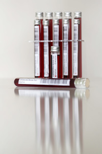 Symbolfoto Coronavirus