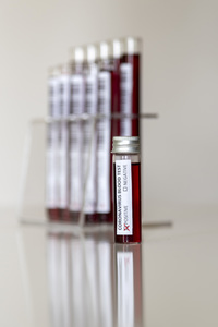 Symbolfoto Coronavirus