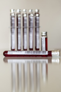 Symbolfoto Coronavirus