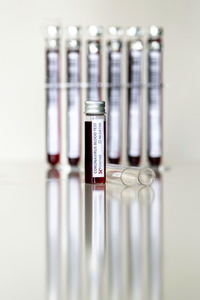 Symbolfoto Coronavirus