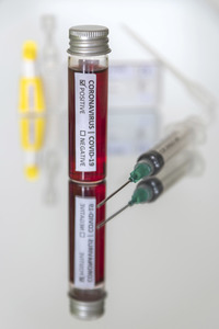 Symbolbild Antikörper-Test für Coronavirus