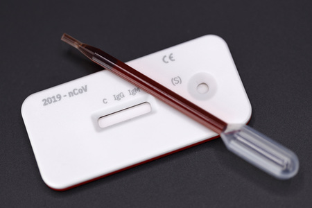 Symbolfoto Corona-Test