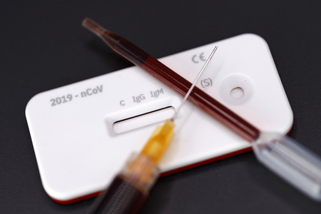 Symbolfoto Corona-Test