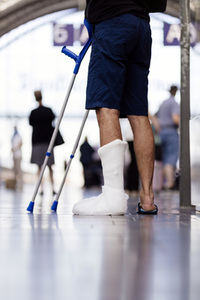 Symbolfoto Beinbruch