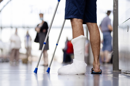 Symbolfoto Beinbruch