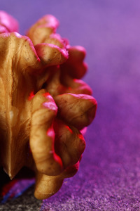 Symbolfoto Hirnthrombose