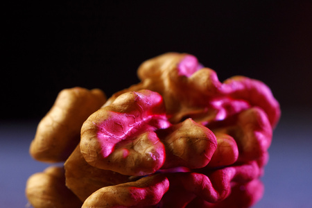 Symbolfoto Hirnthrombose