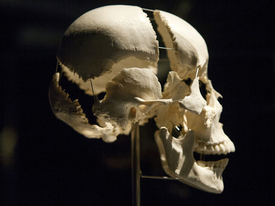 Ausstellung 'Body Worlds - The Rhythm of Life' in Madrid