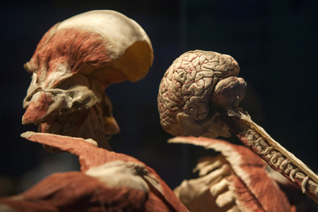 Ausstellung 'Body Worlds - The Rhythm of Life' in Madrid