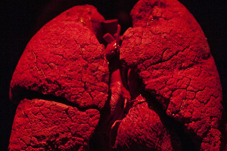 Ausstellung 'Body Worlds - The Rhythm of Life' in Madrid