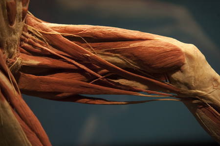 Ausstellung 'Body Worlds - The Rhythm of Life' in Madrid