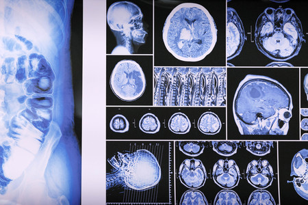 Symbolfoto Kriminaltechnisches Labor