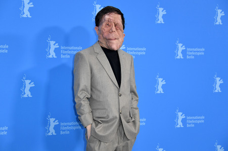 Photocall 'A Different Man', Berlinale 2024