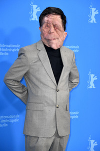 Photocall 'A Different Man', Berlinale 2024